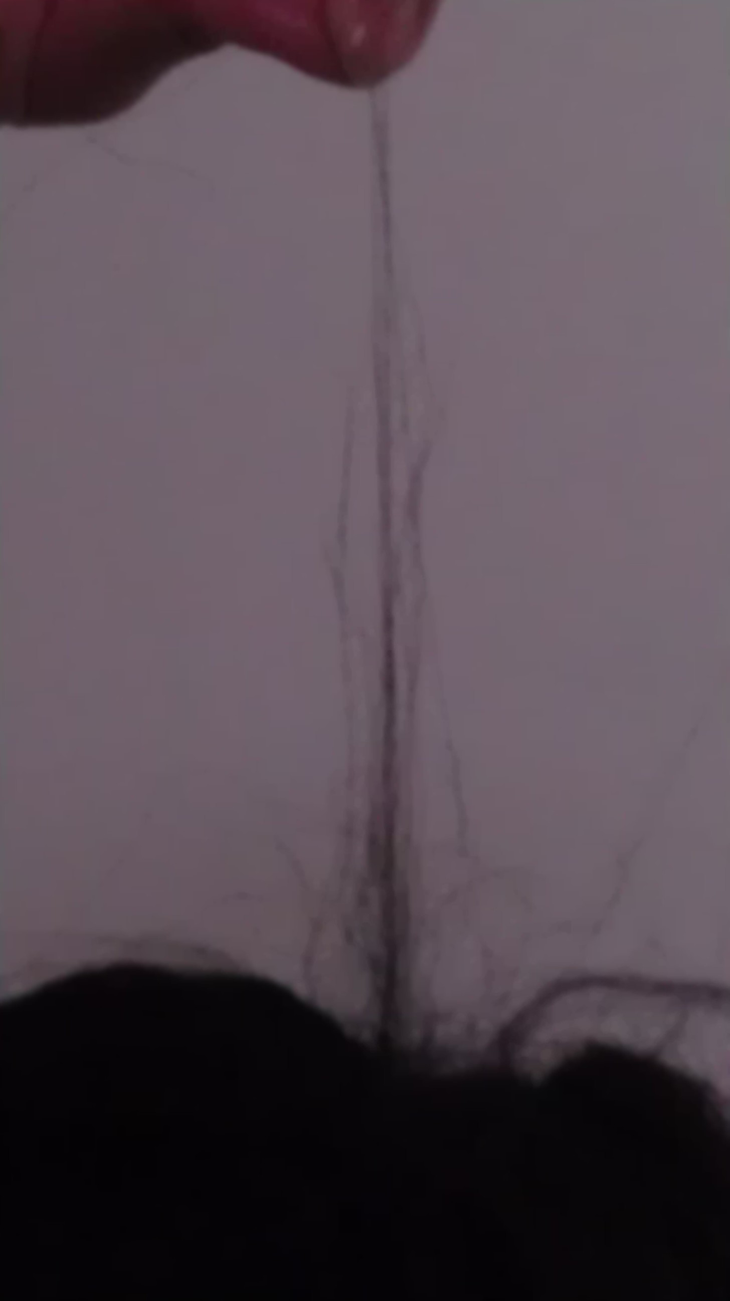 hair setback crown breakage for having tangled hair